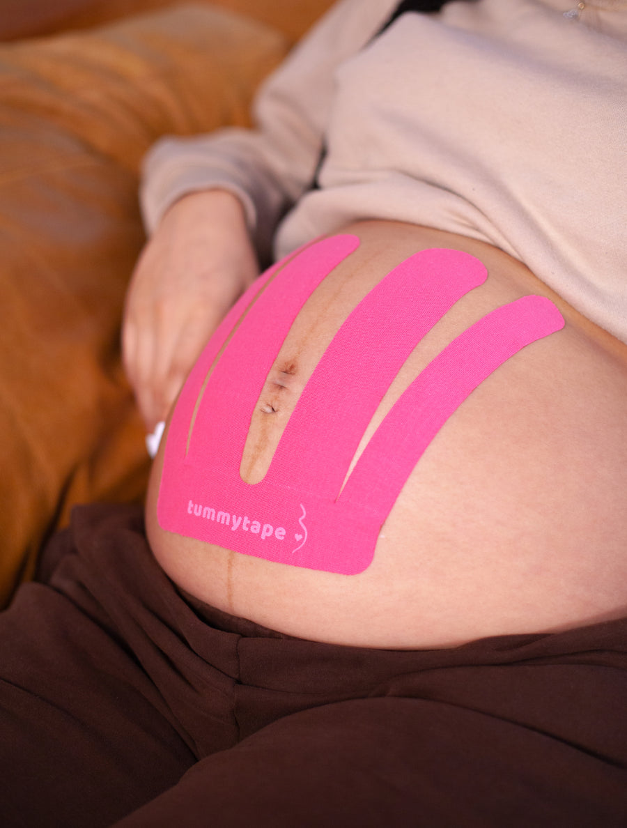 baby belly supported by pink tummytape pregnancy tape